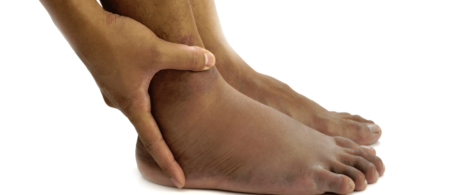 How Fast Does Neuropathy Progress?